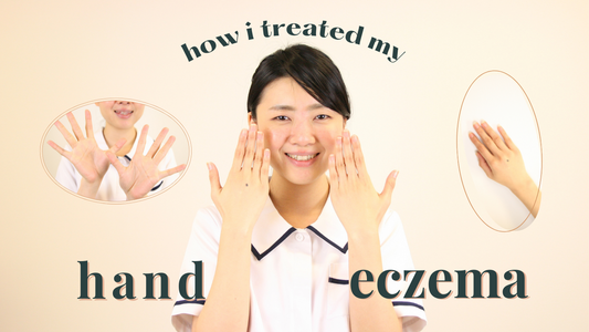 blog feature image user experience cure hand eczema