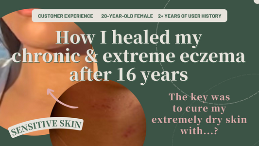 blog feature image how i healed my chronic and extreme eczema 