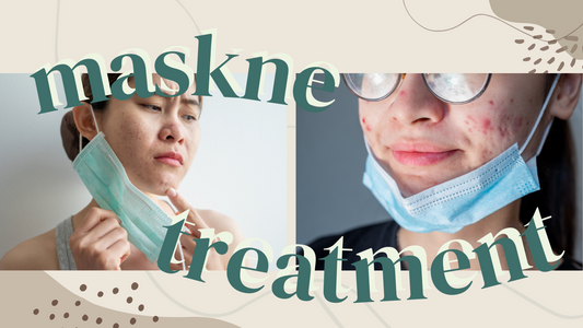 blog feature image maskne breakout treatment